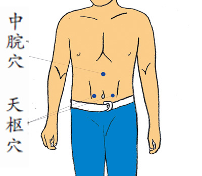 针灸并用治慢性胃炎