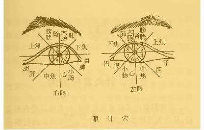 耳针,头针及眼针法禁忌