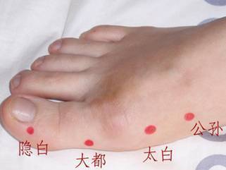 针灸隐白治疗功能性子宫出血